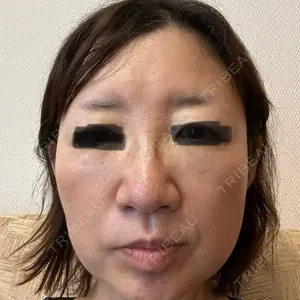 ゆきスキンクリニック 東池袋口コミ