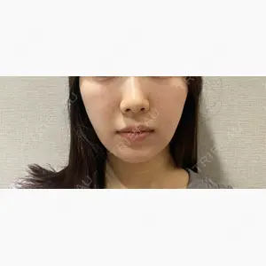 Nクリニック伏見口コミ