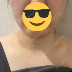 ネビュラクリニック 広島院口コミ