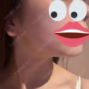 セギム美容整形外科口コミ