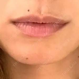 HAAB×DREAM BEAUTY CLINIC 東京本院口コミ