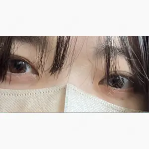 LUHO（ルホ）美容外科口コミ