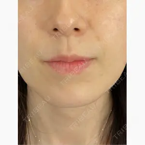 藤・ナチュレ美容クリニック 銀座院口コミ