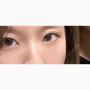 ルラ美容クリニック 大阪本院口コミ