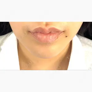 藤・ナチュレ美容クリニック 銀座院口コミ