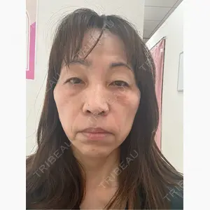 ルラ美容クリニック 大阪本院口コミ