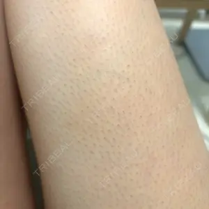 ルラ美容クリニック 神戸院口コミ