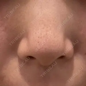 東京素肌クリニック 新宿院口コミ