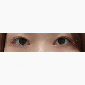 R Beauty CLINIC 大阪院口コミ