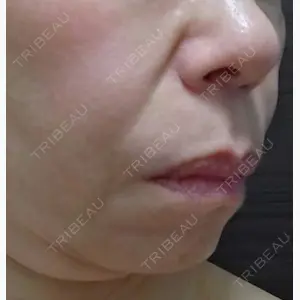 TCB東京中央美容外科 静岡院口コミ