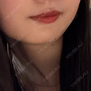 ルラ美容クリニック 札幌院口コミ