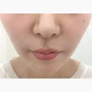 TCB東京中央美容外科 福岡博多院口コミ