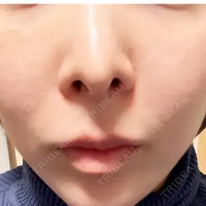 HANABI整形外科口コミ