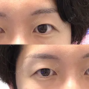 けやき美容クリニック 沼津院口コミ