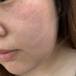 東京形成美容外科 船橋院口コミ