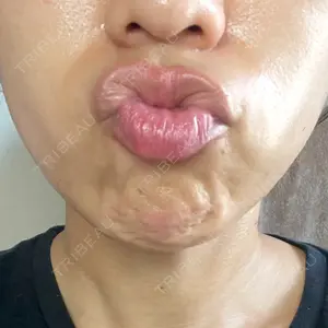 Re:anne clinic 銀座 【リアンクリニック銀座】口コミ