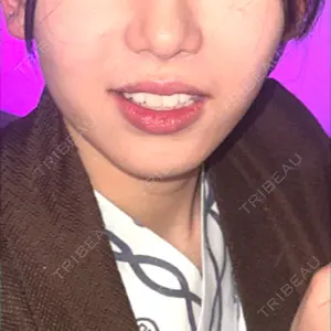 東京美専クリニック口コミ