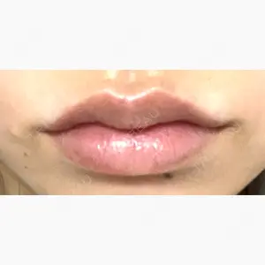ルラ美容クリニック 大阪本院口コミ
