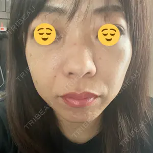 ヴァージンクリニック 広島院口コミ