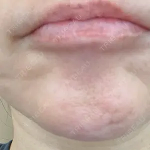 あいち栄クリニック口コミ