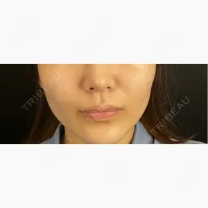 藤・ナチュレ美容クリニック 銀座院口コミ