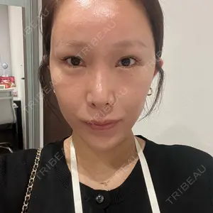 東京美容外科 梅田院口コミ