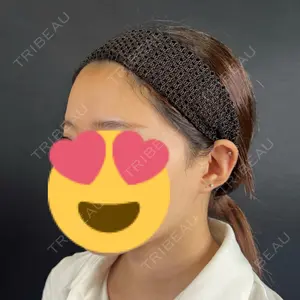 藤・ナチュレ美容クリニック 銀座院口コミ