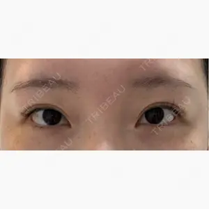 AYANAフィラーズクリニック 渋谷院口コミ