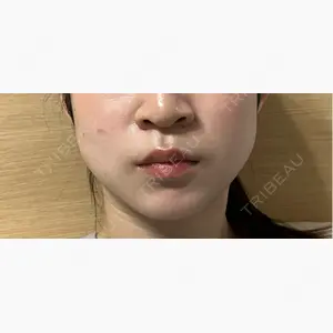 フォンタナクリニック天神口コミ