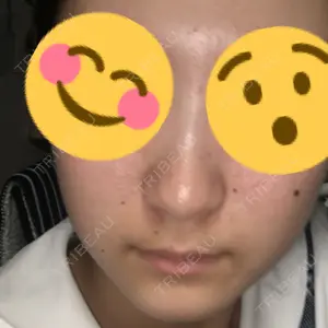 ネクストスキンケアクリニック口コミ