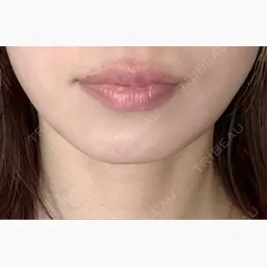 PRISM Beauty Clinic 町田院口コミ