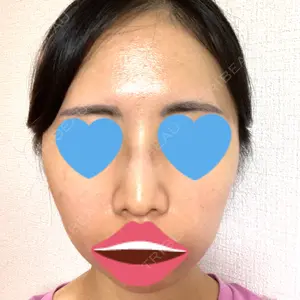 加美（GAMI）整形外科口コミ