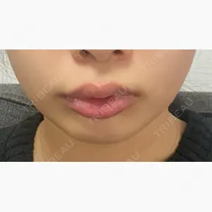 Wi Clinic （ウィ クリニック）心斎橋院口コミ