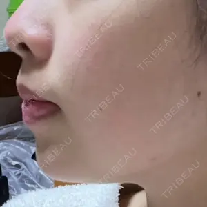 ルラ美容クリニック 渋谷本院口コミ