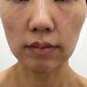 東京シンデレラ美容外科 池袋院口コミ