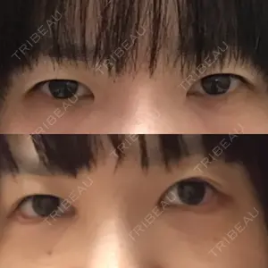 ジュエリー美容外科口コミ