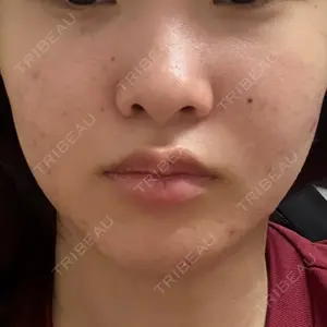 DAILY SKIN CLINIC 福岡院口コミ