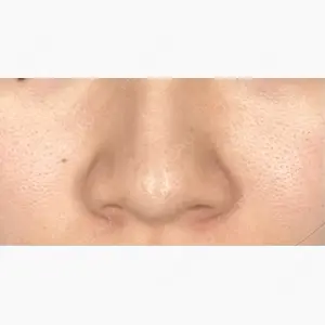 グローバルビューティークリニック 大阪院口コミ