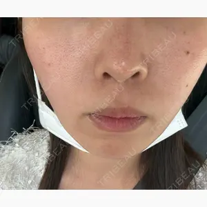 DAILY SKIN CLINIC 福岡院口コミ