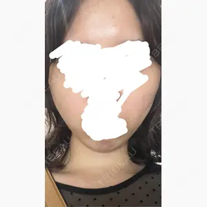 AB美容クリニック 新宿院口コミ