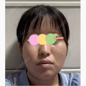 コントアクリニック 東京口コミ