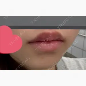 ロレシー美容クリニック 心斎橋駅前院口コミ