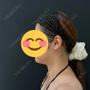 湘南美容クリニック Regno 銀座院口コミ