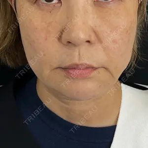 藤・ナチュレ美容クリニック 銀座院口コミ