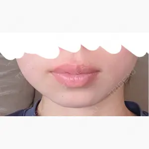 銀座みゆき通り美容外科 大阪梅田院口コミ