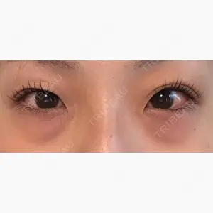 銀座みゆき通り美容外科 大阪梅田院口コミ