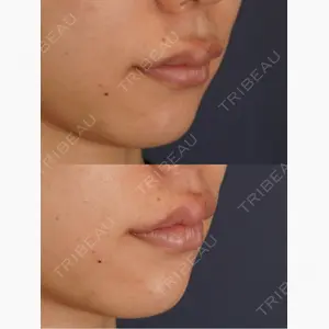 LIVIN CLINIC口コミ