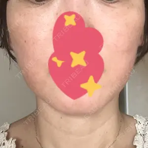 B-LINE CLINIC 大阪院口コミ