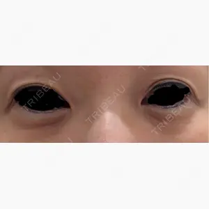 銀座みゆき通り美容外科 大阪梅田院口コミ