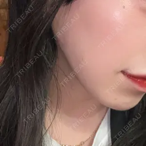 大美会クリニック 梅田院口コミ
